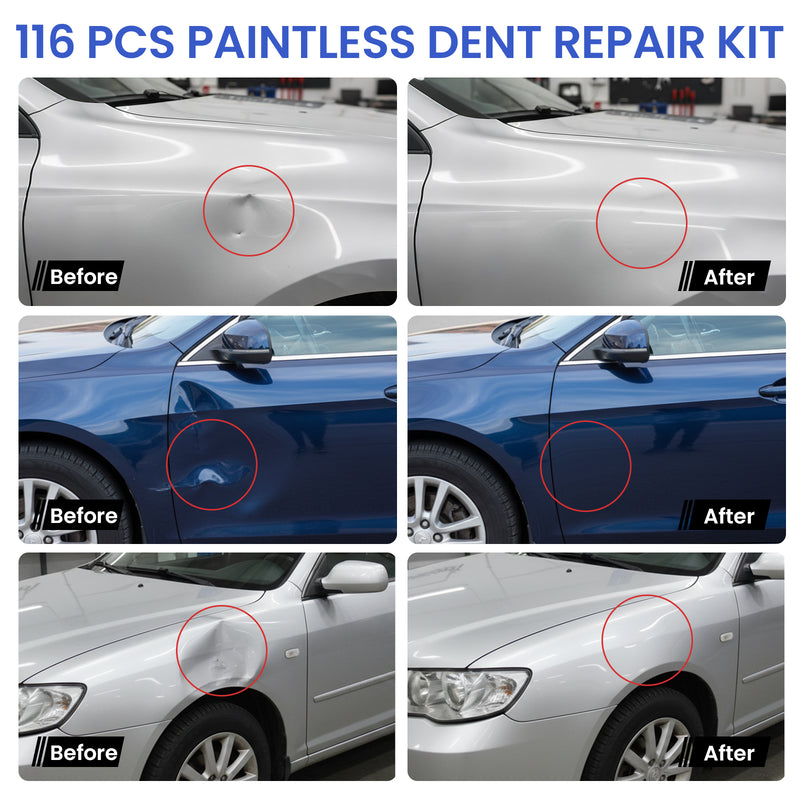 Advwin 116 PCS Car Dent Repair Kit with Golden Lifter